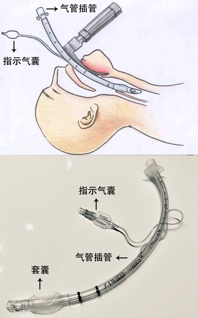 贊！?。?50萬指示氣囊，客戶100%滿意！